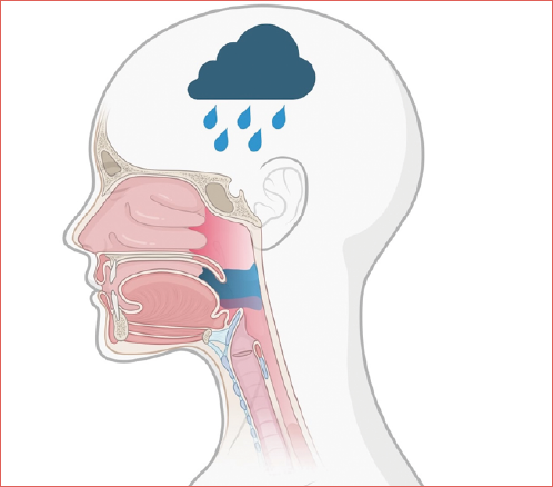 Depression in patients with oropharyngeal cancer: represents a significant issue in contemporary head and neck oncology.