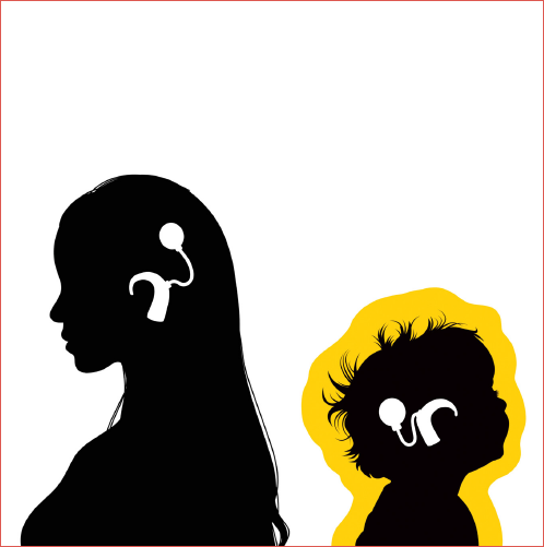 Cochlear implant for children.