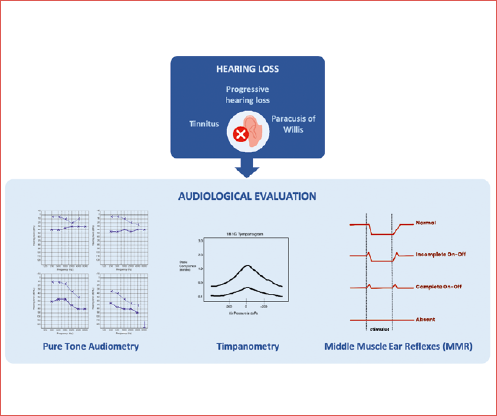 The image summarises the essential tools used to diagnose and characterize hearing impairment in otosclerosis.