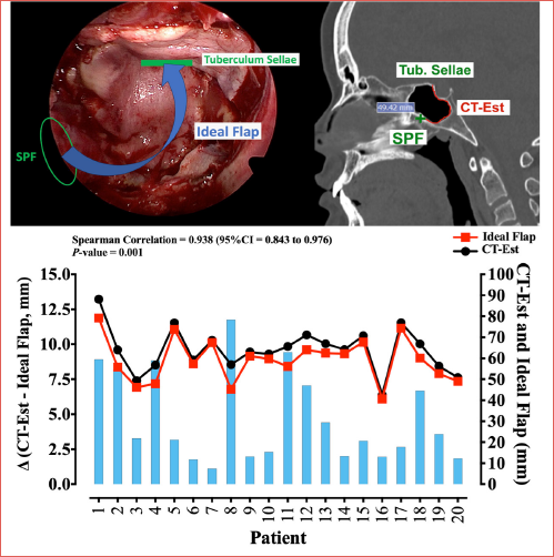 Ideal Flap (top left) represents the flap length considered optimal, based on intraoperative measurements. CT-Est (top right) represents the flap length estimated by CT. The lower section shows the individual values of these variables and their difference, in mm.