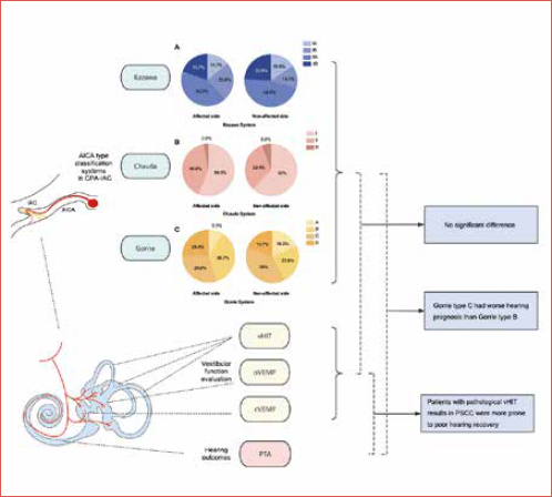 No association between vestibular testing results and radiological neurovascular compression signs in the cerebellopontine angle-internal auditory canal region was found in patients with idiopathic sensorineural hearing loss (ISSNHL). The hearing outcomes of ISSNHL patients was correlated with vestibular compromise rather than neurovascular compression signs.